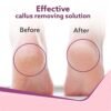 AGARO Callus Remover with 3 Interchangeable Head Rollers, Electronic Foot Scrubber For Callus... - Image 5