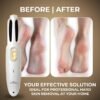 Winston Callus Remover for Feet Electronic Foot Scrubber for Dead Skin, Electric Pedicure Mac... - Image 6