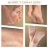 Winston Callus Remover for Feet Electronic Foot Scrubber for Dead Skin, Electric Pedicure Mac... - Image 3